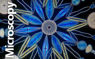 Microscopy - Heine condenser lens Slide | Vista Focus